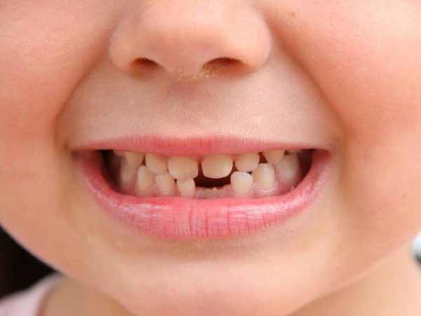 Chiêm bao thấy rụng răng liệu có phải vận xui?
